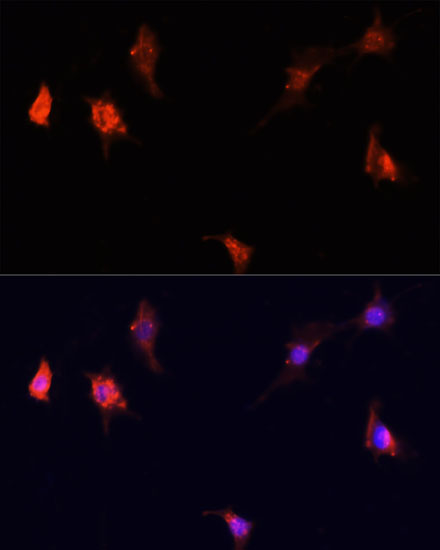 mTOR Rabbit polyclonal antibody
