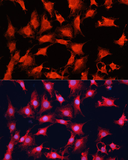 mTOR Rabbit polyclonal antibody