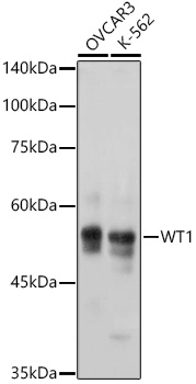 WT1 Rabbit monoclonal antibody