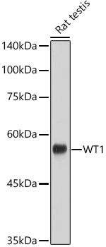 WT1 Rabbit monoclonal antibody