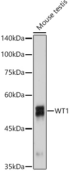 WT1 Rabbit monoclonal antibody