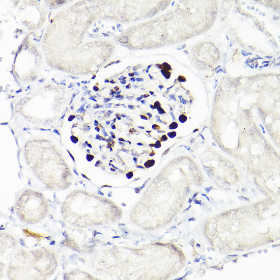 WT1 Rabbit monoclonal antibody