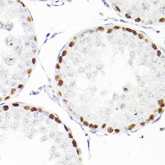 WT1 Rabbit monoclonal antibody