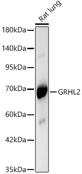 GRHL2 Rabbit polyclonal antibody