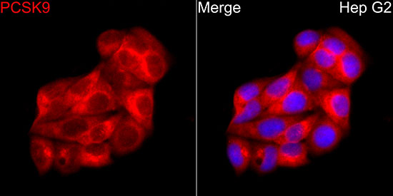 PCSK9 Rabbit polyclonal antibody