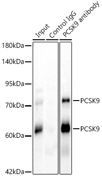 PCSK9 Rabbit polyclonal antibody