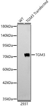 TGM3 Rabbit polyclonal antibody