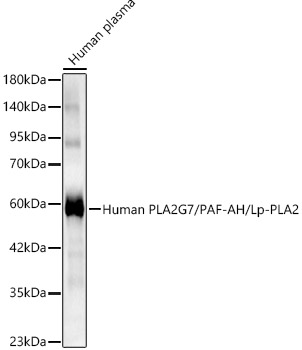 Human PLA2G7/PAF-AH/Lp-PLA2 Rabbit pAb