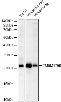 TMEM176B Rabbit polyclonal antibody