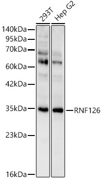 RNF126 Rabbit polyclonal antibody
