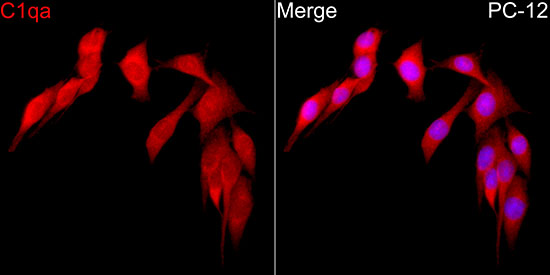 C1qa Rabbit polyclonal antibody
