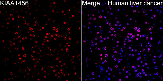 KIAA1456 Rabbit polyclonal antibody