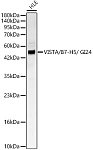 Western blot - VISTA / B7-H5 / GI24 Rabbit pAb (A24535)
