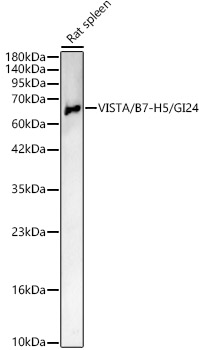 VISTA / B7-H5 / GI24 Rabbit polyclonal antibody