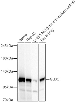 GLDC Rabbit polyclonal antibody