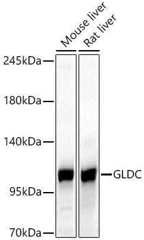 GLDC Rabbit polyclonal antibody