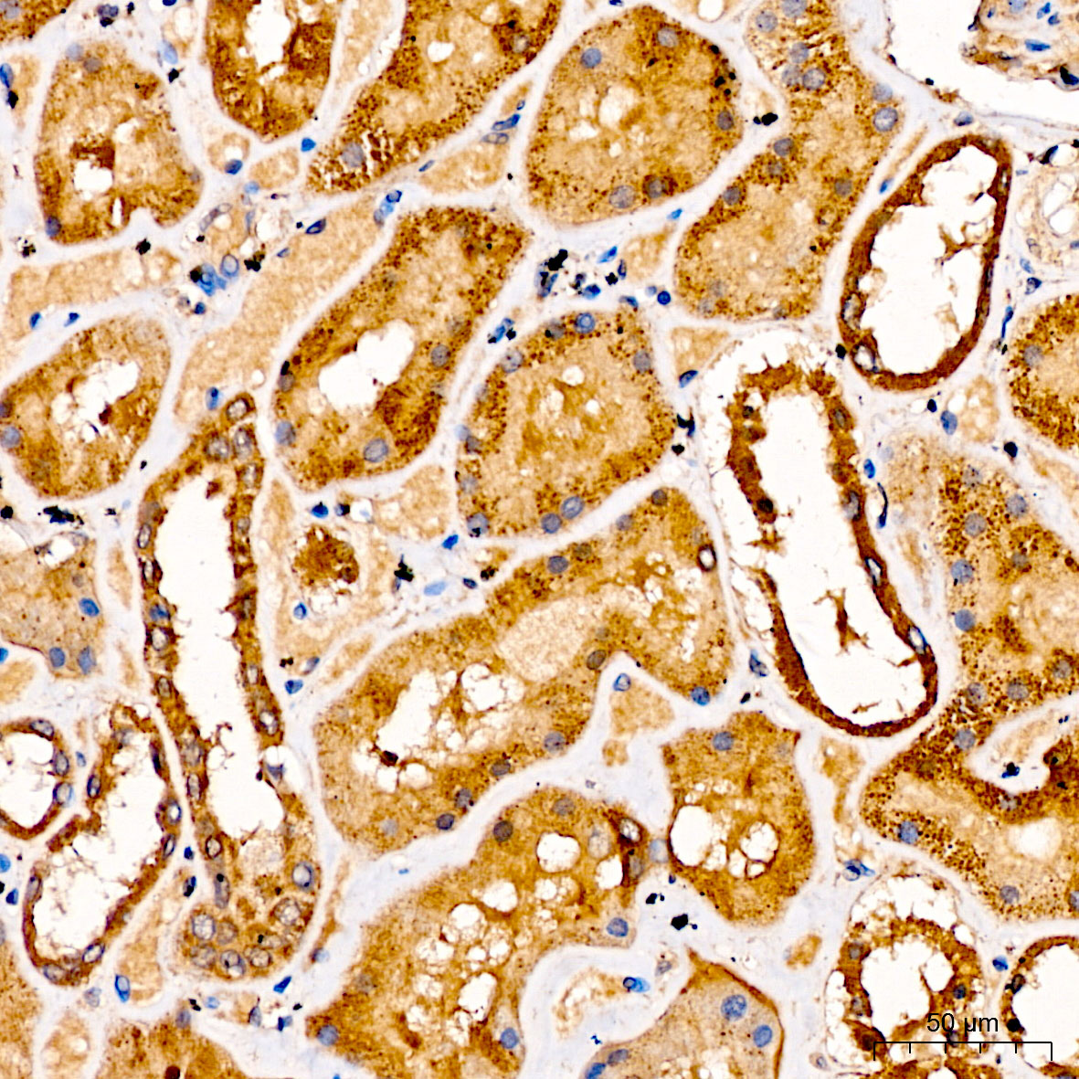 GLDC Rabbit polyclonal antibody