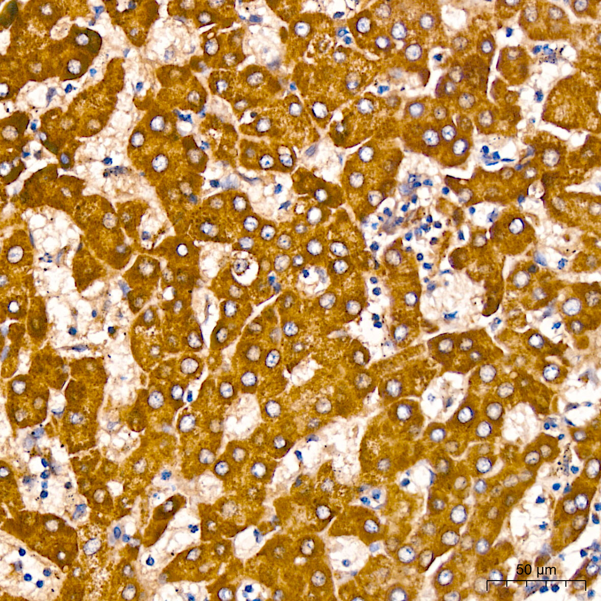 GLDC Rabbit polyclonal antibody