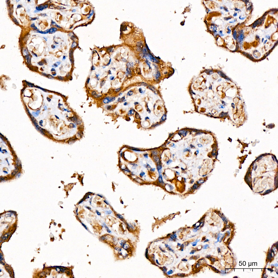 GLDC Rabbit polyclonal antibody