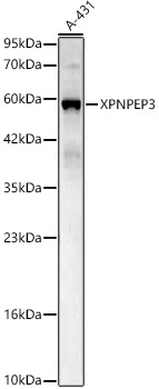 XPNPEP3 Rabbit polyclonal antibody