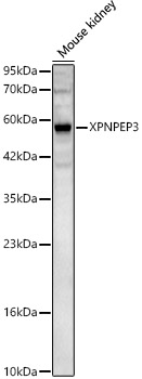 XPNPEP3 Rabbit polyclonal antibody