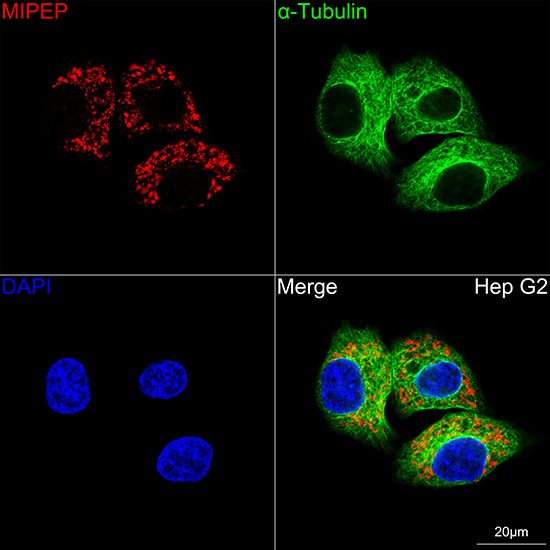 MIPEP Rabbit monoclonal antibody
