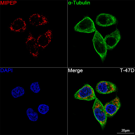 MIPEP Rabbit monoclonal antibody