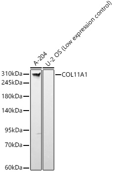 COL11A1 Rabbit monoclonal antibody