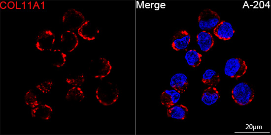 COL11A1 Rabbit monoclonal antibody