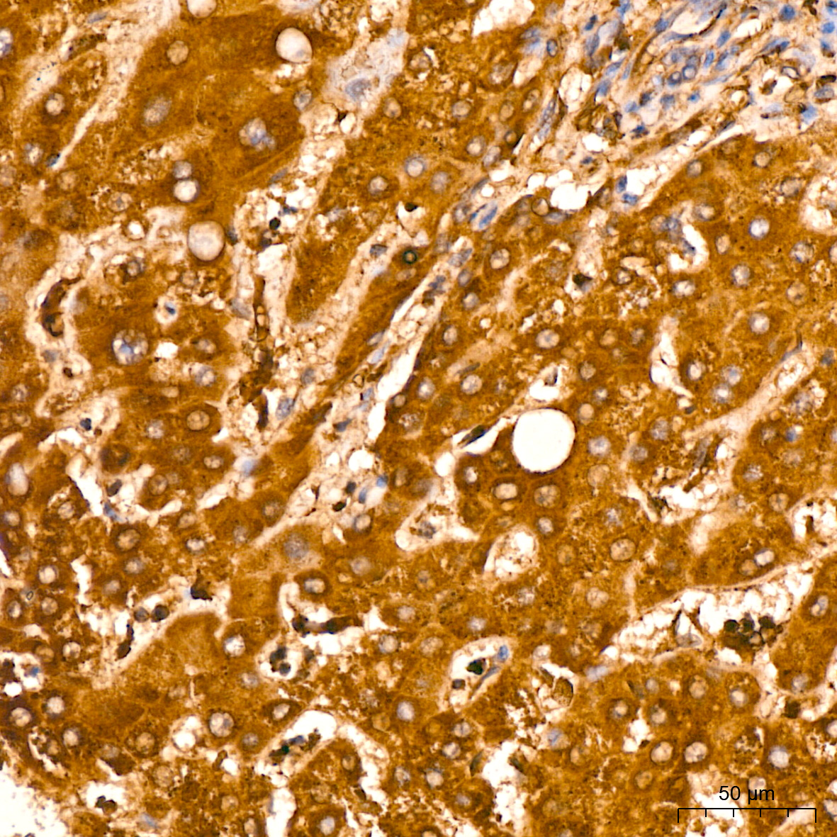 PMPCA Rabbit monoclonal antibody