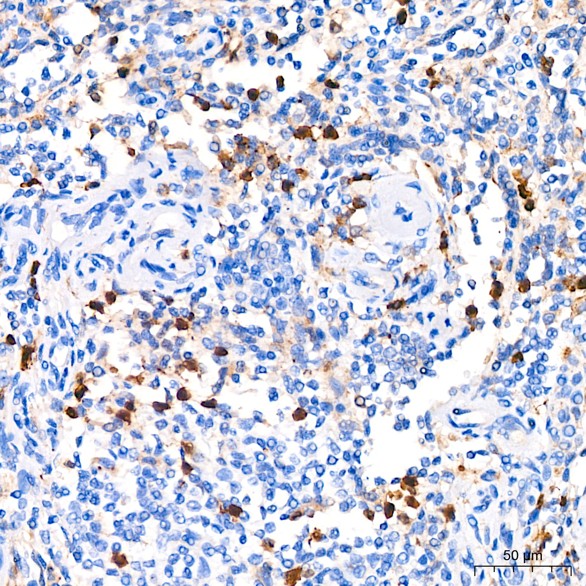 CDA Rabbit monoclonal antibody