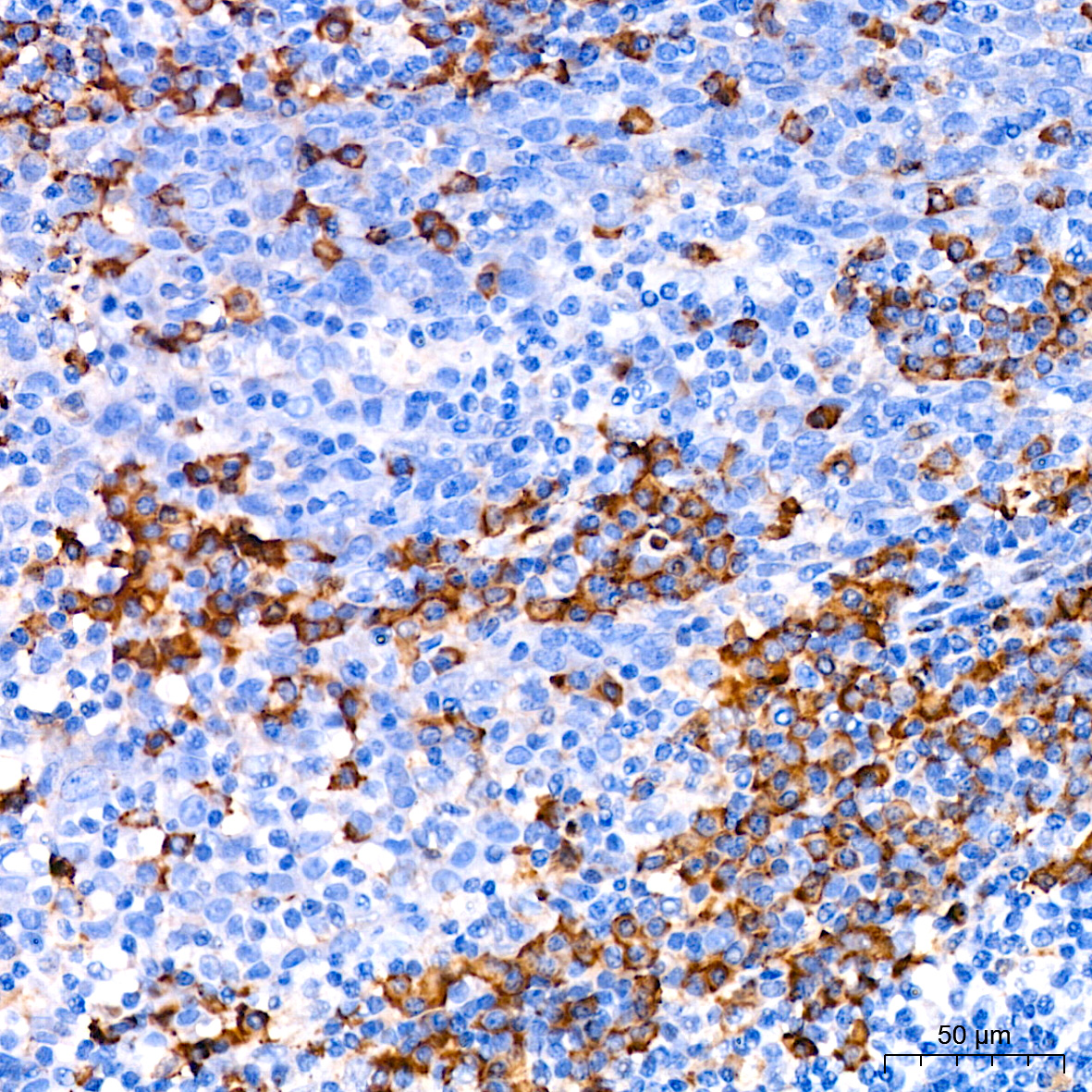 CDA Rabbit monoclonal antibody