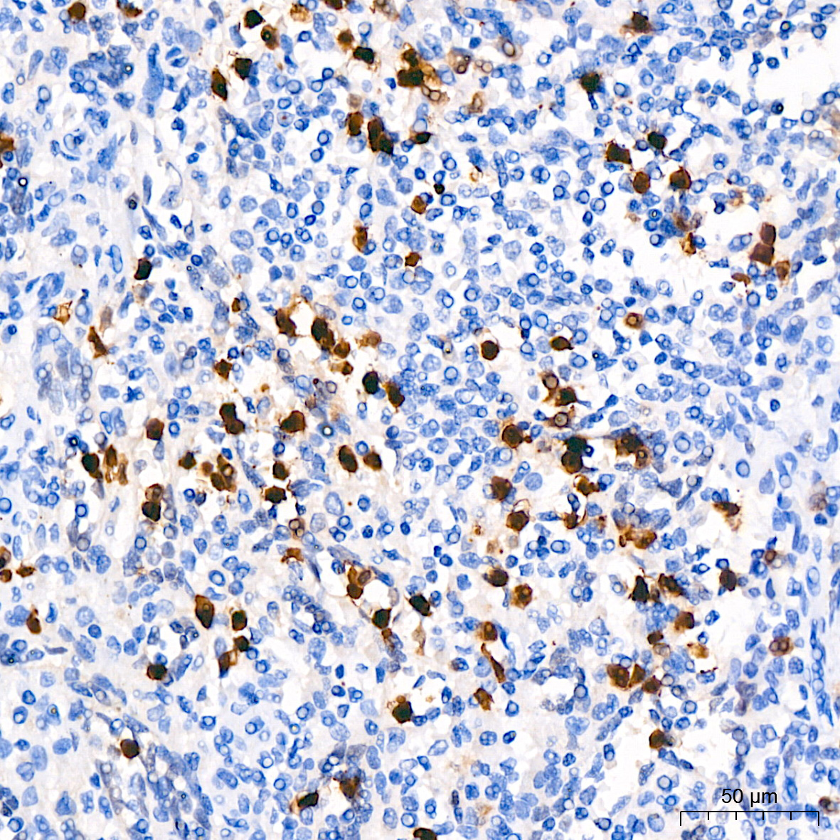 CDA Rabbit monoclonal antibody