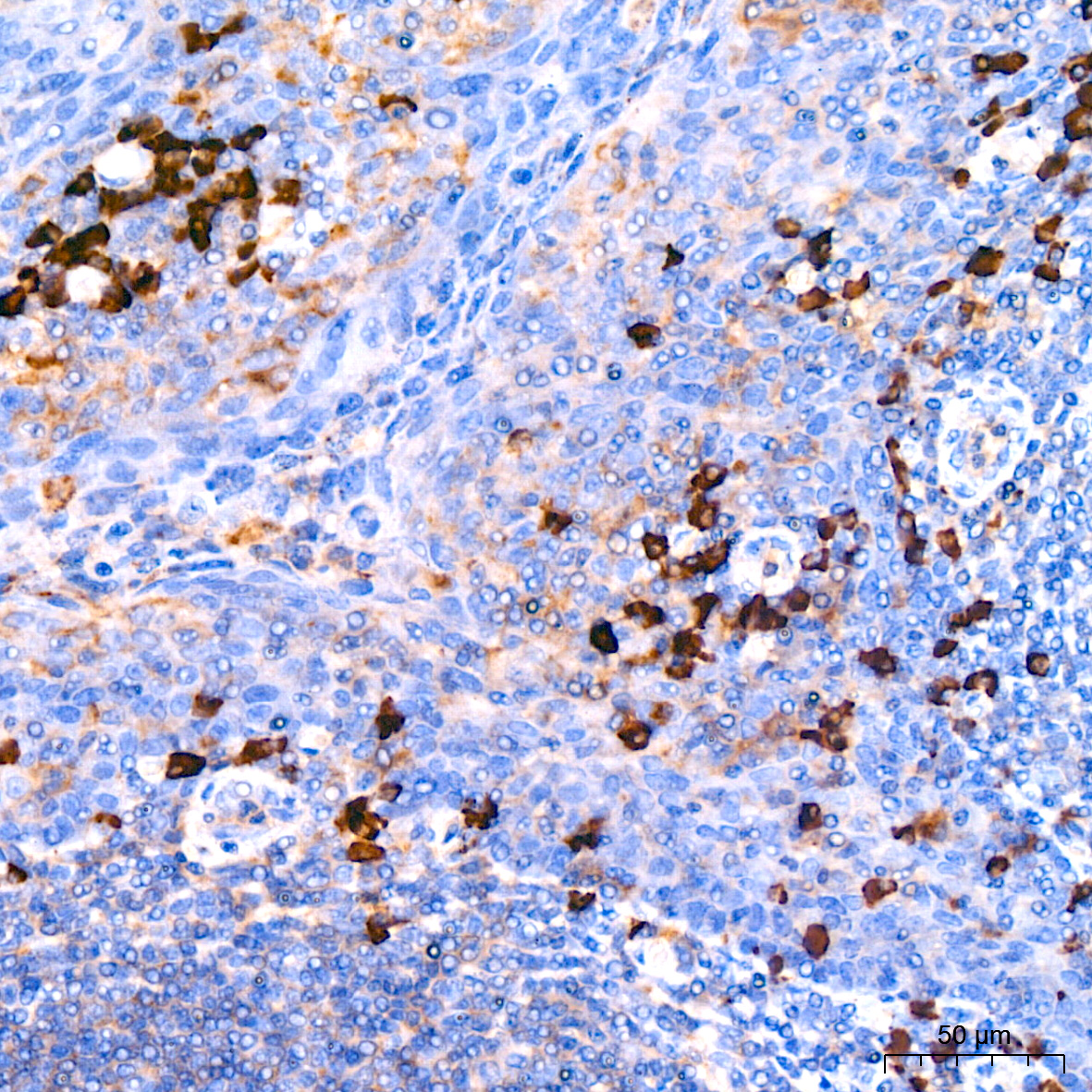 Human Lambda Light Chain Rabbit monoclonal antibody