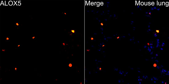ALOX5 Rabbit monoclonal antibody