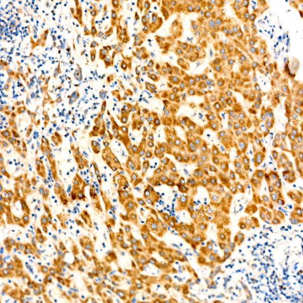 BCKDHB Rabbit monoclonal antibody