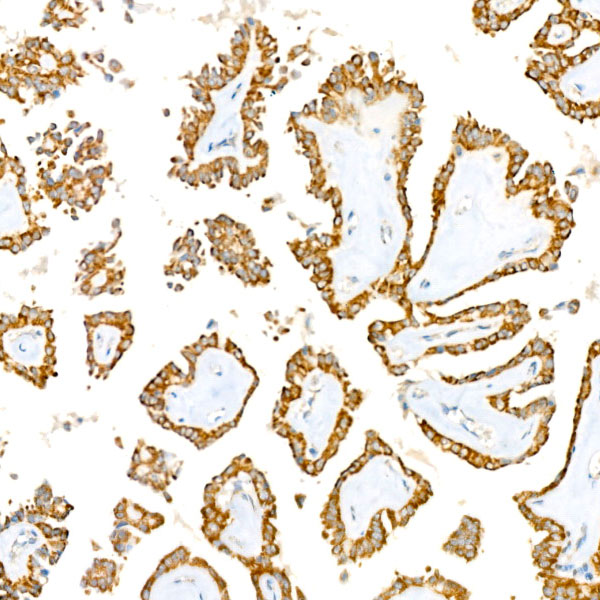 BCKDHB Rabbit monoclonal antibody