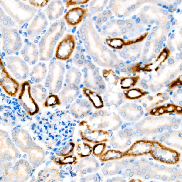 BCKDHB Rabbit monoclonal antibody