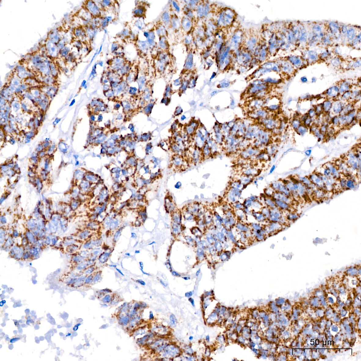 ATPIF1 Rabbit monoclonal antibody