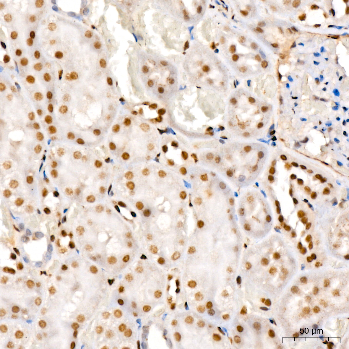 COUP-TFII/NR2F2 Rabbit monoclonal antibody