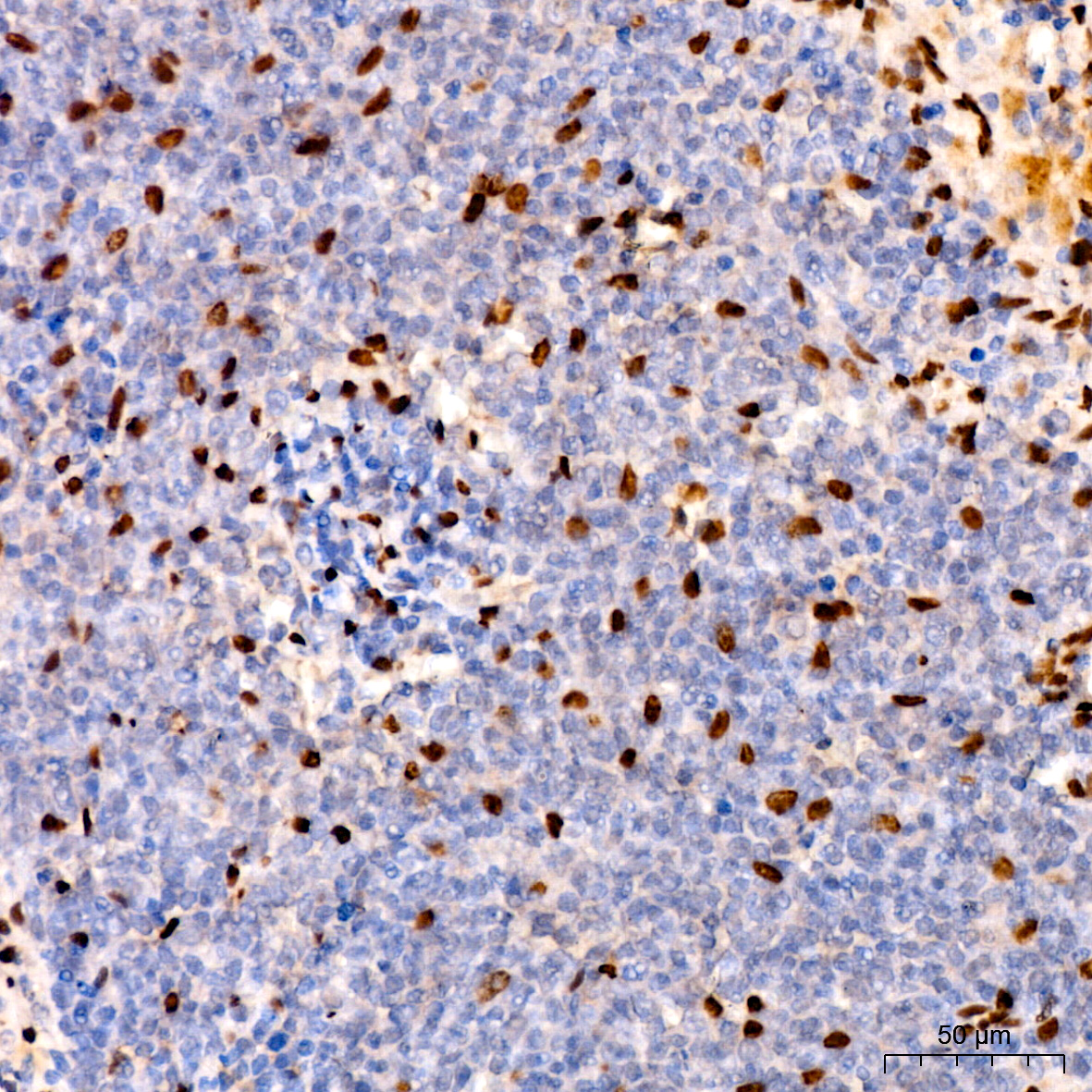 COUP-TFII/NR2F2 Rabbit monoclonal antibody