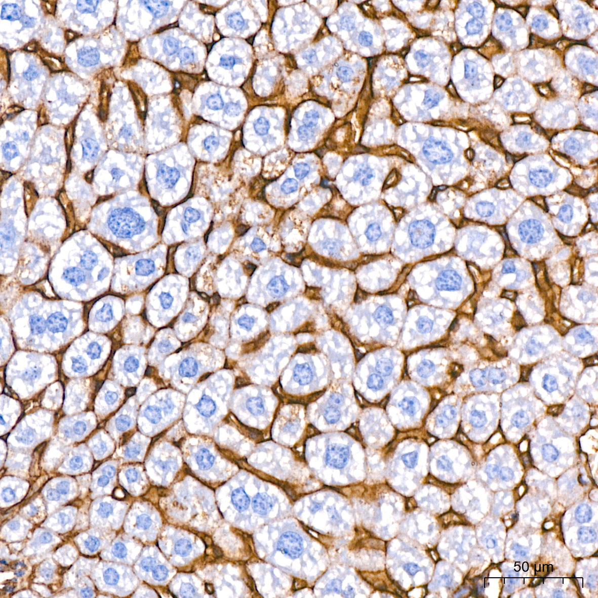 ICAM-1/CD54 Rabbit monoclonal antibody