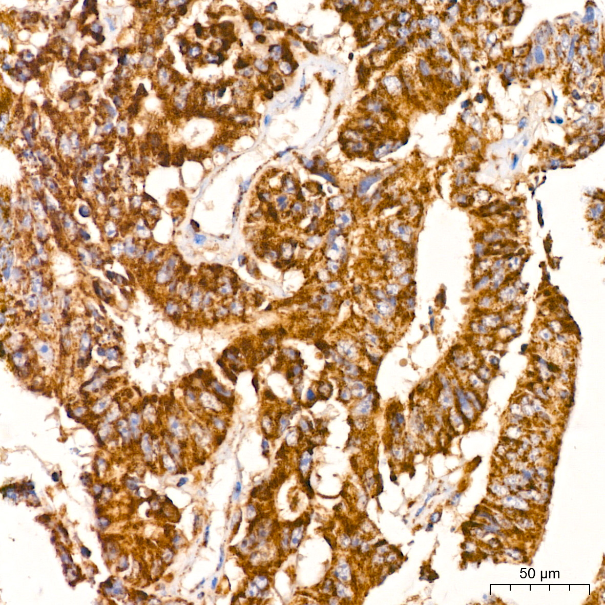 PITRM1 Rabbit monoclonal antibody