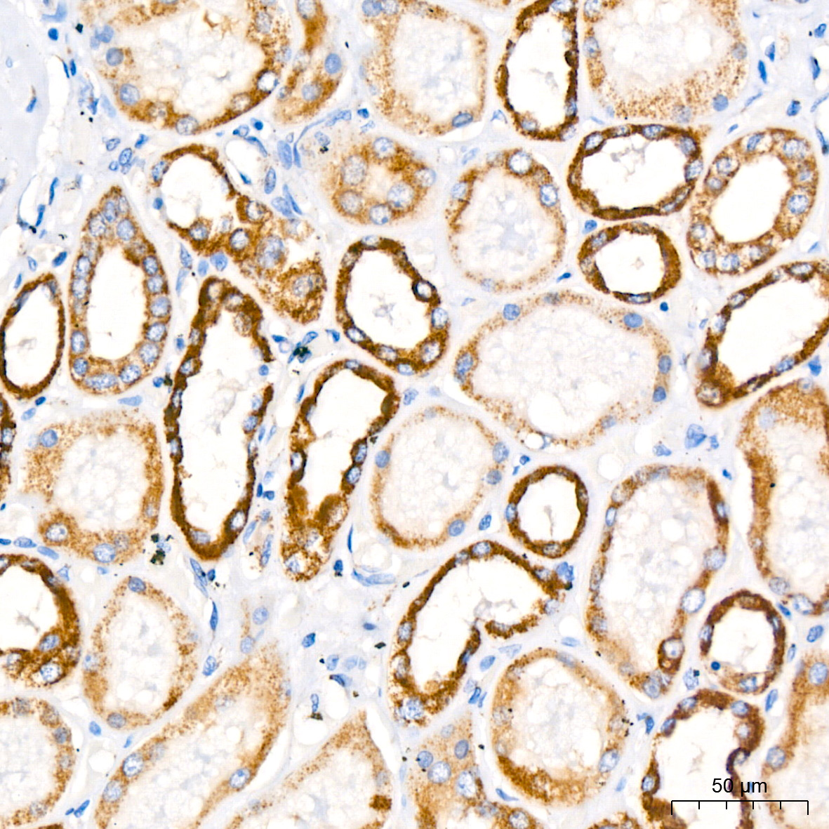 PITRM1 Rabbit monoclonal antibody