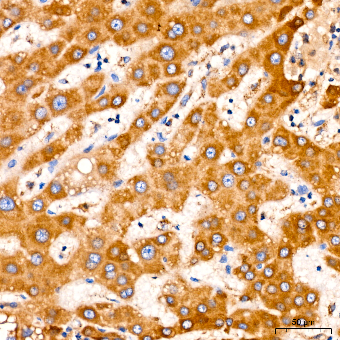 PITRM1 Rabbit monoclonal antibody