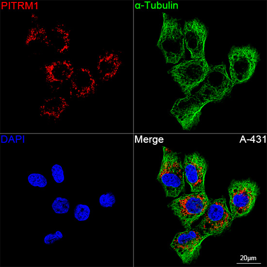 PITRM1 Rabbit monoclonal antibody