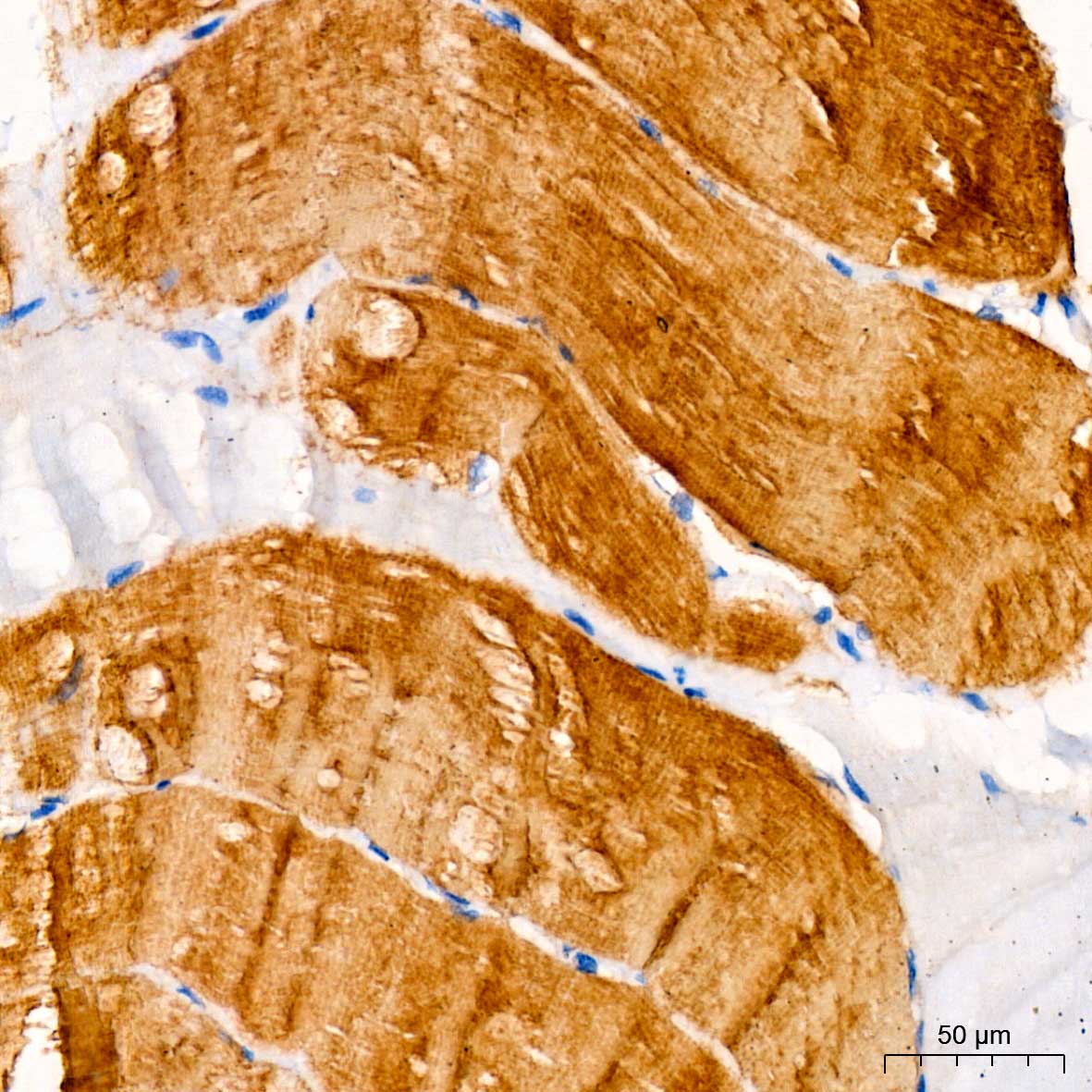 MYH7 Rabbit polyclonal antibody