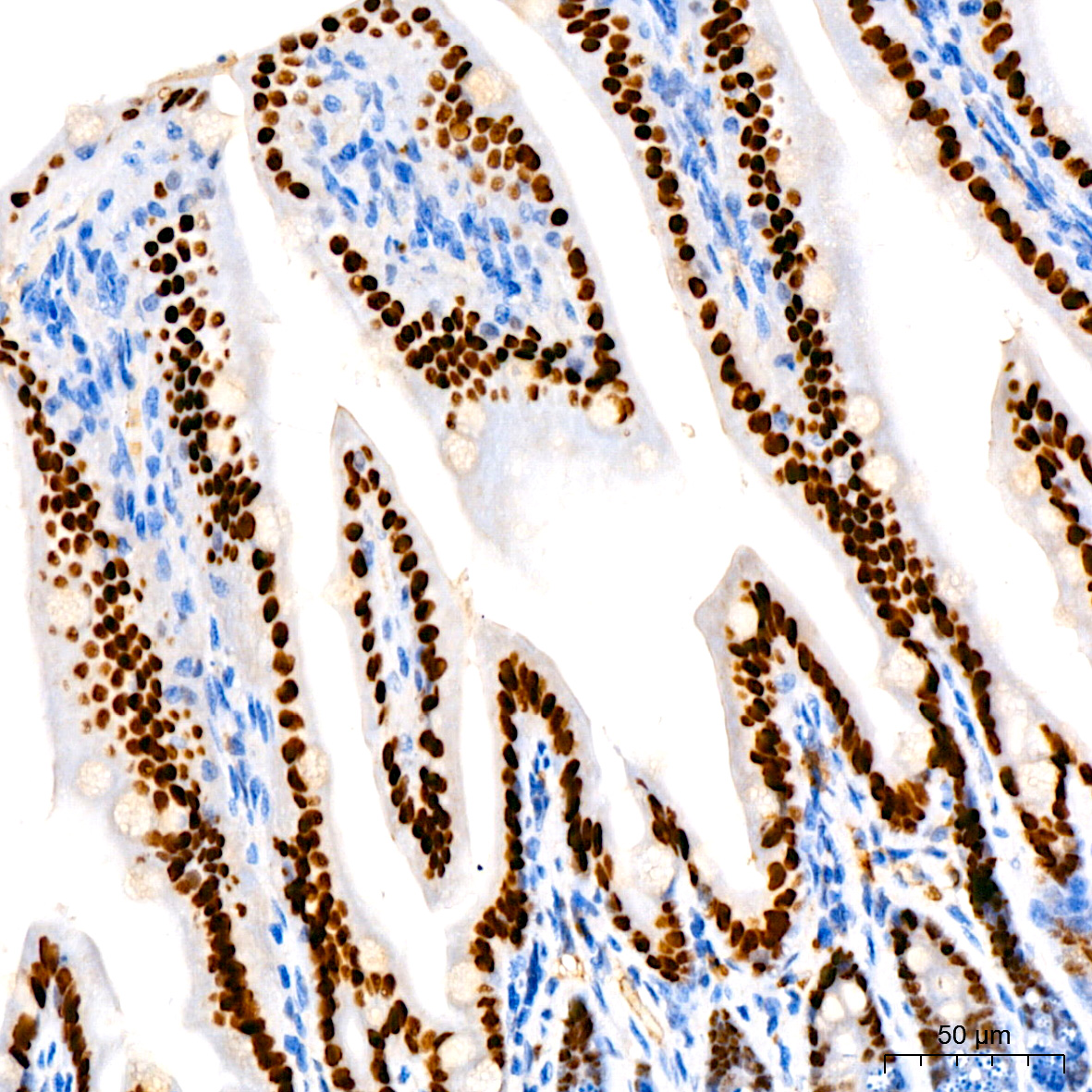 HNF4G Rabbit monoclonal antibody