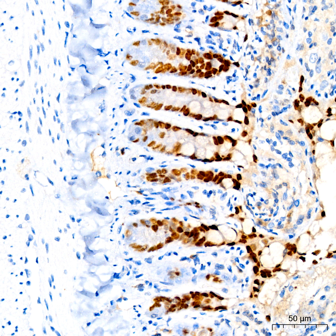 HNF4G Rabbit monoclonal antibody