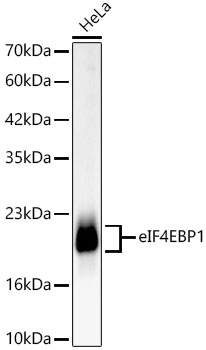 [KD Validated] eIF4EBP1 Rabbit monoclonal antibody